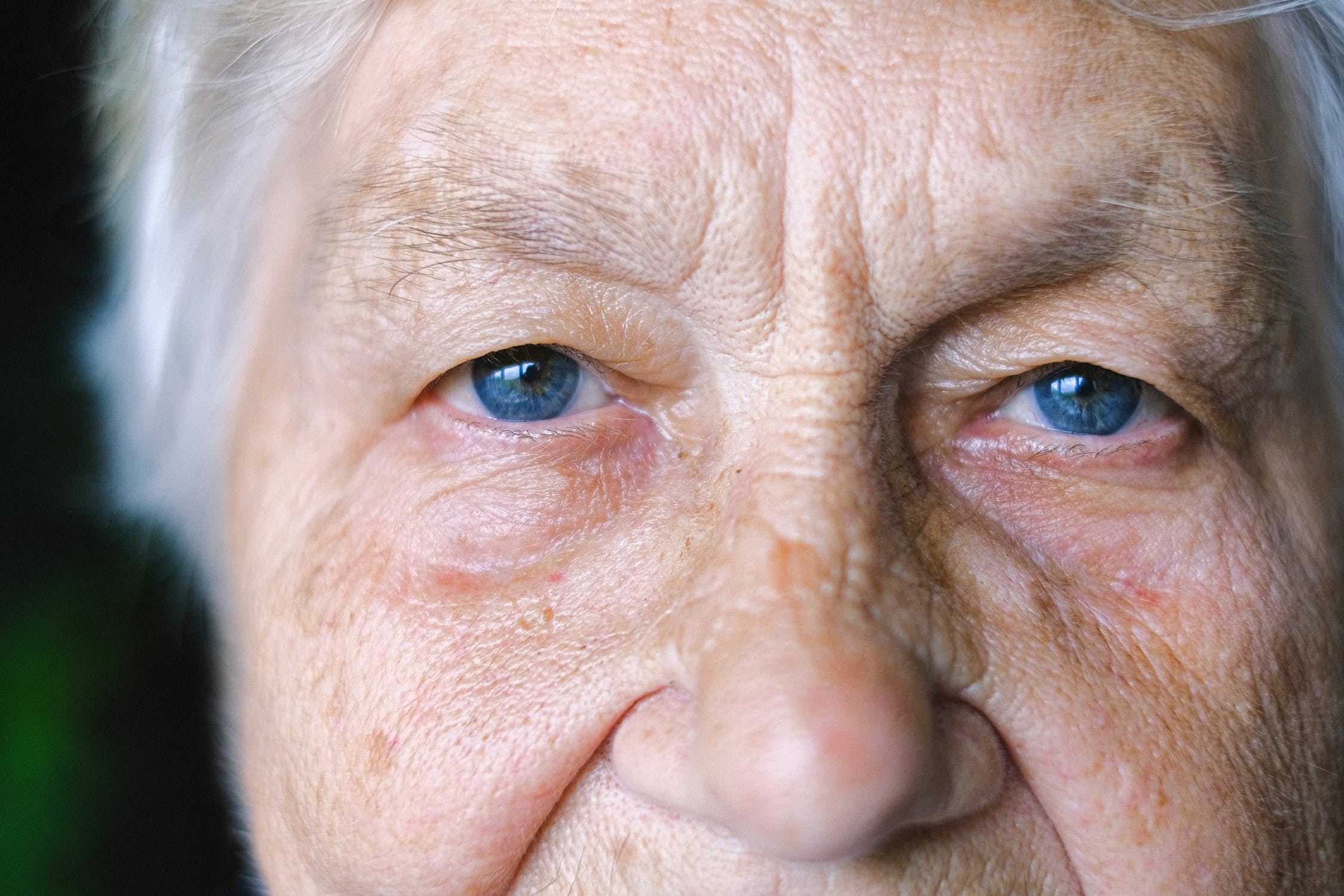 Read more about the article Info on Cataracts with Dr. Rocha